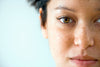 Hyperpigmentierung im Gesicht: So wirst du sie endlich los - Header Bild Frau mit Pigmemtflecken